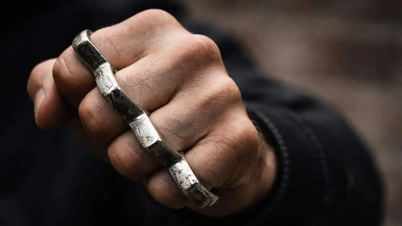 Agresion puno americano fractura huesos cara altercado Valladolid